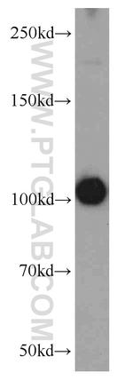 PDE2A Antibody in Western Blot (WB)