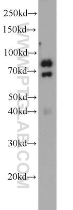 PAMR1 Antibody in Western Blot (WB)
