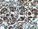 ATP6 Antibody in Immunohistochemistry (Paraffin) (IHC (P))