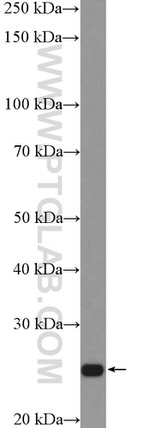 ATP6 Antibody in Western Blot (WB)