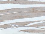 ATP6 Antibody in Immunohistochemistry (Paraffin) (IHC (P))