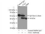 TAL1 Antibody in Immunoprecipitation (IP)