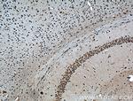 MYO5A Antibody in Immunohistochemistry (Paraffin) (IHC (P))