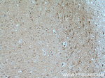 SH2D5 Antibody in Immunohistochemistry (Paraffin) (IHC (P))