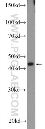 SH2D5 Antibody in Western Blot (WB)