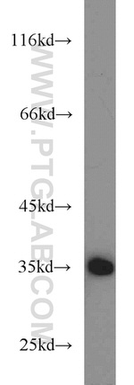 SH2D5 Antibody in Western Blot (WB)