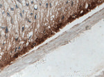 Involucrin Antibody in Immunohistochemistry (Paraffin) (IHC (P))