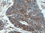 Involucrin Antibody in Immunohistochemistry (Paraffin) (IHC (P))