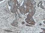 Involucrin Antibody in Immunohistochemistry (Paraffin) (IHC (P))