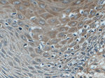 Involucrin Antibody in Immunohistochemistry (Paraffin) (IHC (P))