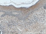 Involucrin Antibody in Immunohistochemistry (Paraffin) (IHC (P))