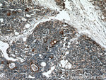 Involucrin Antibody in Immunohistochemistry (Paraffin) (IHC (P))