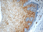 Involucrin Antibody in Immunohistochemistry (Paraffin) (IHC (P))
