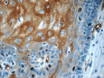 Involucrin Antibody in Immunohistochemistry (Paraffin) (IHC (P))