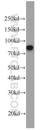 Involucrin Antibody in Western Blot (WB)