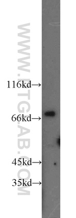 Involucrin Antibody in Western Blot (WB)