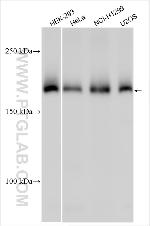 CLCN3 Antibody in Western Blot (WB)
