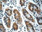 SEPN1 Antibody in Immunohistochemistry (Paraffin) (IHC (P))