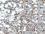 STK38 Antibody in Immunohistochemistry (Paraffin) (IHC (P))