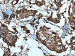 STK38 Antibody in Immunohistochemistry (Paraffin) (IHC (P))
