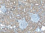STK38 Antibody in Immunohistochemistry (Paraffin) (IHC (P))