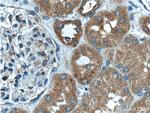 STK38 Antibody in Immunohistochemistry (Paraffin) (IHC (P))