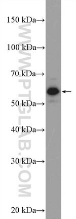 STK38 Antibody in Western Blot (WB)