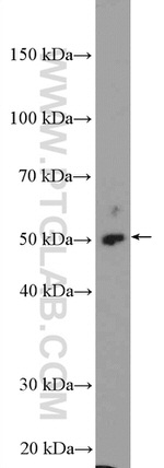 STK38 Antibody in Western Blot (WB)