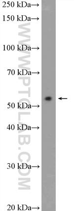 STK38 Antibody in Western Blot (WB)