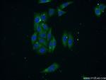 RNASE3 Antibody in Immunocytochemistry (ICC/IF)