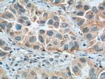 RNASE3 Antibody in Immunohistochemistry (Paraffin) (IHC (P))