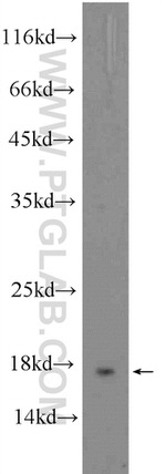 RNASE3 Antibody in Western Blot (WB)