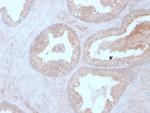 Calcineurin B/PPP3R1 Monoclonal Antibody (CALNB, 2342)