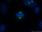 CEP78 Antibody in Immunocytochemistry (ICC/IF)