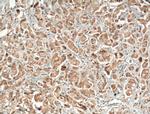 CEP78 Antibody in Immunohistochemistry (Paraffin) (IHC (P))