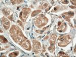 CEP78 Antibody in Immunohistochemistry (Paraffin) (IHC (P))