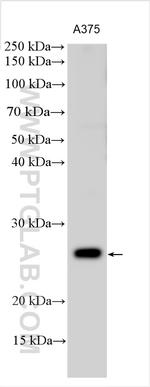 ELA1 Antibody in Western Blot (WB)
