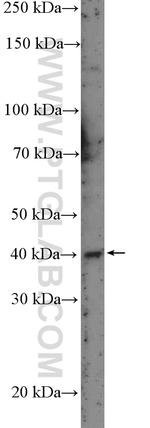 PRKACG Antibody in Western Blot (WB)