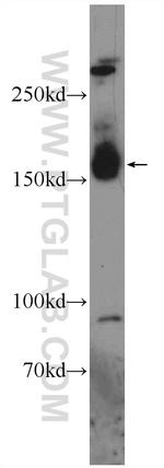 JMJD3 Antibody in Western Blot (WB)