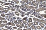 FGFR3 Antibody in Immunohistochemistry (Paraffin) (IHC (P))