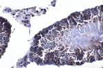 FGFR3 Antibody in Immunohistochemistry (Paraffin) (IHC (P))