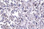 FGFR3 Antibody in Immunohistochemistry (Paraffin) (IHC (P))