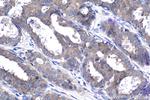 FGFR3 Antibody in Immunohistochemistry (Paraffin) (IHC (P))