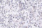 FGFR3 Antibody in Immunohistochemistry (Paraffin) (IHC (P))