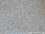 p140Cap Antibody in Immunohistochemistry (Paraffin) (IHC (P))