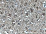 p140Cap Antibody in Immunohistochemistry (Paraffin) (IHC (P))