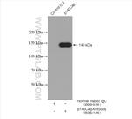 p140Cap Antibody in Immunoprecipitation (IP)