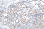 FOXE1 Antibody in Immunohistochemistry (Paraffin) (IHC (P))