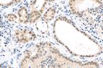 FOXE1 Antibody in Immunohistochemistry (Paraffin) (IHC (P))