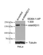 ANKRD11 Antibody in Western Blot (WB)